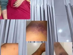 Kasus Penganiayaan di Binjai: Mantan Pacar Anggota Brimob Melapor ke Polisi