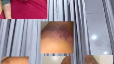 Kasus Penganiayaan di Binjai: Mantan Pacar Anggota Brimob Melapor ke Polisi