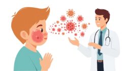 Campak Kembali Jadi Sorotan, Ini Tahapan Infeksi, Gejala, dan Cara Penanganannya